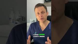 The Future of BPH Treatment: Green Light Laser Explained