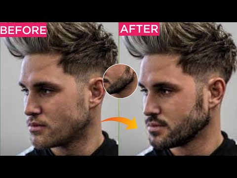 3 Quick beard hack 100% | kya kare agar PATCHY beard ho to ( EASY TIPS )