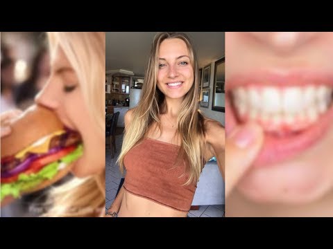 Personal Q/A: Do I Still Binge Eat? Eating Some Meat Again, Cavities as a Vegan + more.