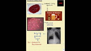 #Shorts|ClinicalCorrelation| NEET/NEXTPG/FMGE/MBBS| Klebsiella Pneumoniae