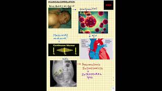 #Shorts|ClinicalCorrelation| NEET/NEXTPG/FMGE/MBBS| Blue Berry Muffin Rash | Rubella | PDA | NEC