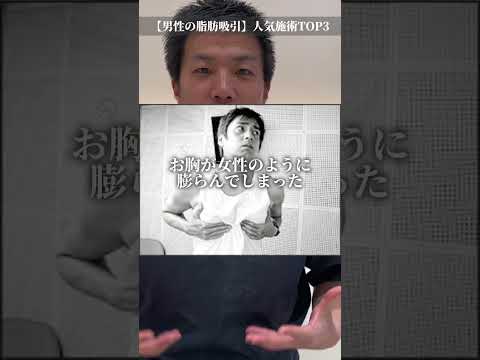 【誇張一切なし】男性も脂肪吸引する時代です。　#shorts