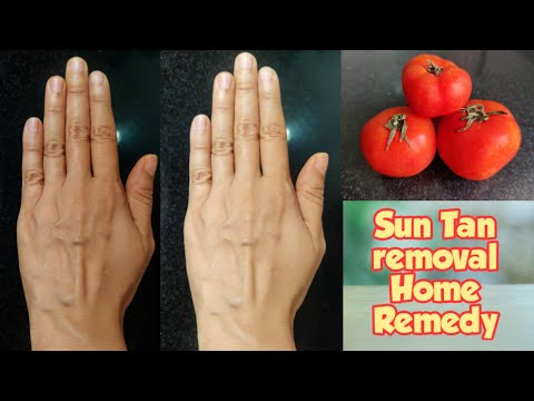 Best & Easy Home Remedy| How to Remove Tan-Sun Tan Removal, Pigmentation & Skin Lightening Treatment