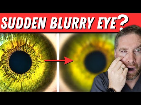 Sudden Blurry Vision In One Eye?! (5 Causes)