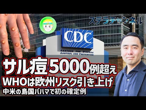 【サル痘】解説、サル痘の確定例が5000例を超える【CDCやWHOの動向、健康】