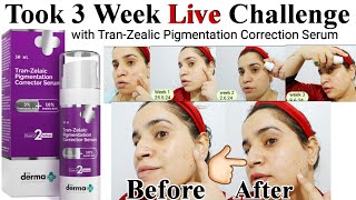 Derma co Tran zealic Pigmentation corrector Serum Review