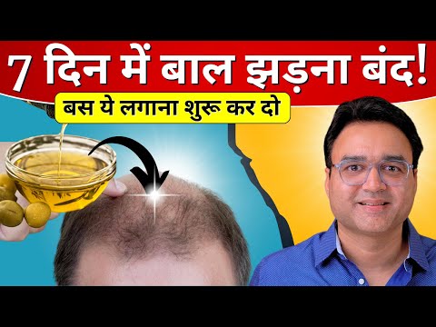 गंजे सर पे भी बाल उगा देंगे ये 4 घरेलु नुस्खे | 4 Natural Remedies for EXTREME HAIR GROWTH