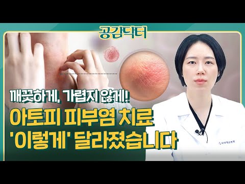 아토피 피부염,  깨끗하고 가렵지 않은 피부로 새로고침 하세요! | 공감닥터