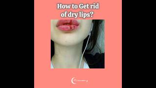 How to get rid of dry lips..!? ✨ #shortsviral #aesthetic #useful #teens #makeuptip #Skincaretip