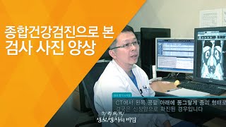 종합건강검진으로 본 검사 사진 양상 - (2012.1.28_399회 방송)_아는 만큼 건강해진다, 종합건강검진