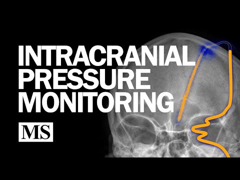 External Ventricular Drainage and Intracranial Pressure Monitoring