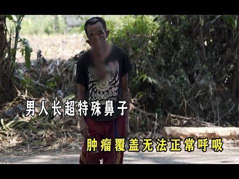 大爷脸上长出无数痘痘，失去自己的工作，反而成为村里万人迷