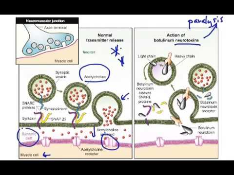 Botulism Toxin