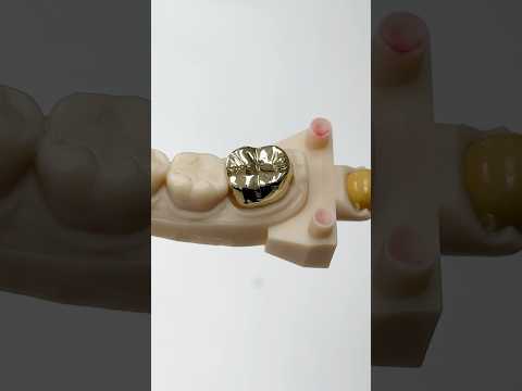 50% Gold Crown #lsk121shorts #dentist #teeth