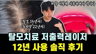 의사인 내가 레이저 탈모 치료기 12년 사용하며 느낀 것들 (feat. 병원용 vs 가정용)