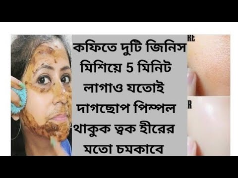 ফেসিয়াল এর চেয়ে ১০ গুন গ্লো একদিনে ত্বকের কালো দাগ ময়লা তুলে ত্বক দুধের মত ফর্সা হবে/Coffee facial