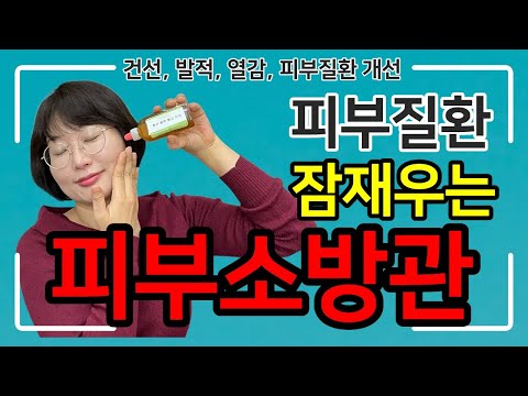 건선, 무좀,  붉은 염증, 아토피, 피부염, 가려움증에 효과가 아주 좋은 약초를 활용하는 방법을 소개합니다! 피부소방관