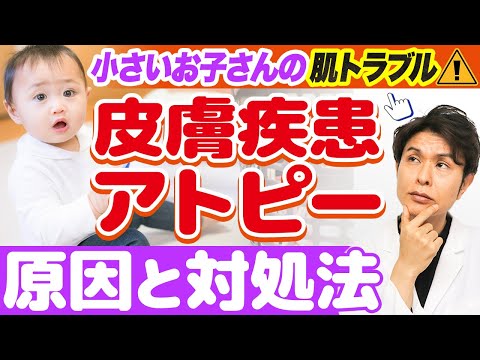 お子さんの皮膚疾患 ( アトピー ) について皮膚科専門医が解説