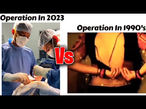 Operation In 2023 Vs Operation In 1990 !! Memes #viralmemes #meme