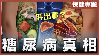 [不是陰謀論]胰島素原本唔洗錢！？｜糖尿病ii可以根治，重點原來係個肝？｜盡早發現，越易逆轉！｜粵語中字