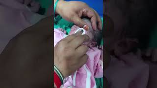 New baby born #cutebaby #newborn #viralvideo #newbornbaby #adorablebaby #babyboy #baby #hospitalcare