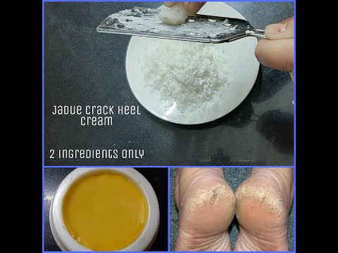 Crack Heel Cream | 2- ingredient miracle crack heel cream