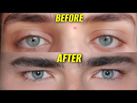 How To Reduce Eyelid Size (Get Hunter Eyes)