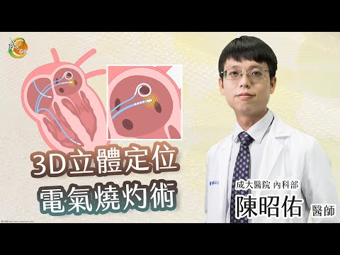 【3D立體定位電氣燒灼術】陳昭佑醫師-成大e學堂