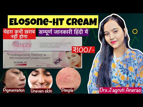 Elosone-HT Cream Indetail | Elosone-HT Cream Review | Gora Aur Saf Chehra | skin brightening cream?