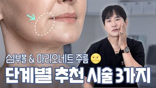 심부볼, 마리오네트 주름 비수술로 깔끔하게 정리하는 3가지 시술 추천