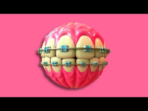 [2025] *FREE* Tyga Type Beat - ''DENTIST'' ft. Offset | Free Club Type Beat