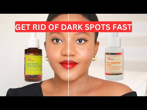 GET RID OF DARK SPOTS | KNOW THE BEST FOR CLEARING DARK SPOTS #goodmolecules #hyperpigmentation