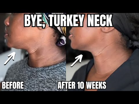 WOW---This Works for Turkey Neck, Rough Texture, Pores & MORE!