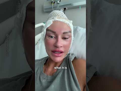 I Got Plastic Surgery In Turkey 🇹🇷😱