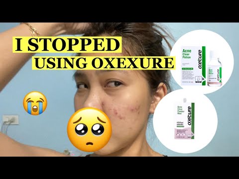 OXECURE REVIEW (skin care for acne skin type) 2021