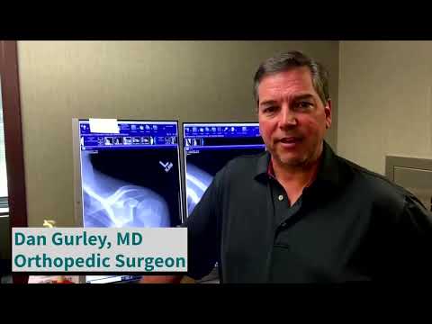 Frozen Shoulder: Dr. Daniel Gurley