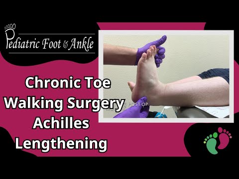 18 Year Old Female Chronic Toe Walking Surgery