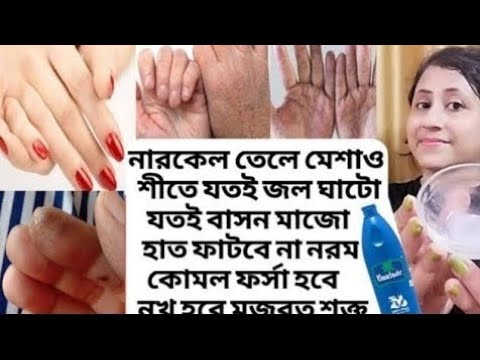 শীতে যতই জল ঘাটো,বাসন মাজো হাত ফাটবে না নরম ফর্সা থাকবে নখ ভাঙবে না/Cracked hand care remedy/Nails