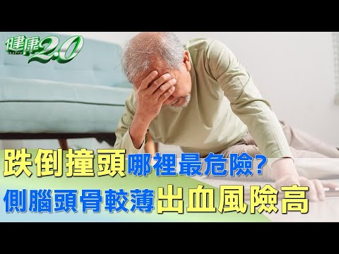 跌倒撞頭哪裡最危險? 側腦頭骨較薄出血風險高 健康2.0 @tvbshealth20