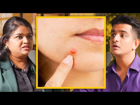 Cure Pimples FAST - Ayurvedic Hacks Explained (In Hindi)