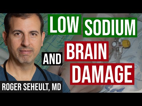 Low Sodium and How to Prevent Osmotic Demyelination Syndrome