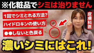 【医師が解説】40代以上の濃いシミも消す一番の方法はこれ！皮膚科医が教える人生を変える本気のシミ治療 |美容医療 | 肝斑| ハイドロキノン