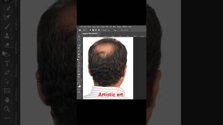 "Learn how to master hair transplant in Photoshop!  #PhotoshopSkills #HairEditing  #PhotoshopTips