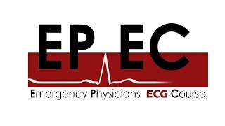 #EPEC ECG Cases (Case 42). Would you activate the cath lab for this one?