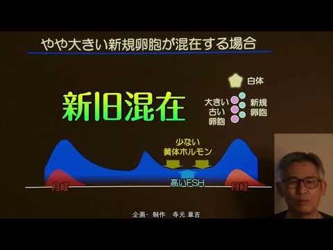 不妊治療ベーシック（第3部）v1a