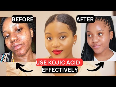 HOW TO PROPERLY USE KOJIC ACID SOAP BAR!