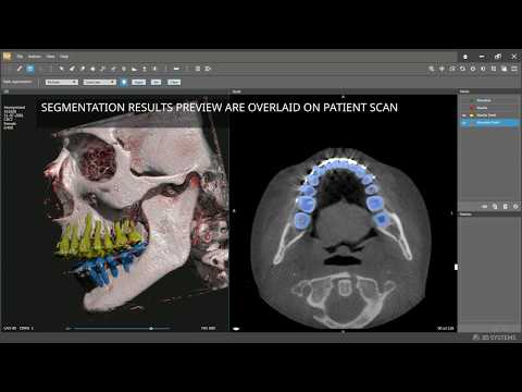 D2P CMF Orthognathic tools