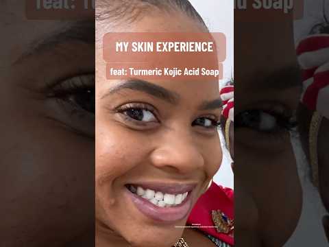 My Skin Experience feat: Turmeric Kojic Acid Soap | Don’t say I ain't never done anything for you!!!