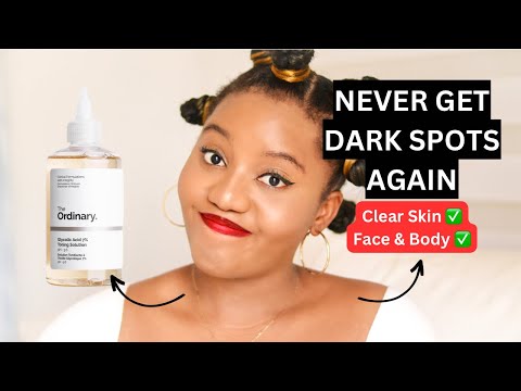 HOW I USE GLYCOLIC ACID TONER FOR THE BEST RESULTS | REDUCE DARK SPOTS FAST!! 😱😱