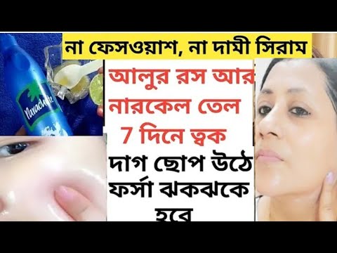 ত্বক হবে দাগহীন ফর্সা উজ্জ্বল গ্লোউইং রাতে লাগিয়ে নাও ঘরে তৈরী আলুর ক্রিম/Potato Facepack/Potato cre